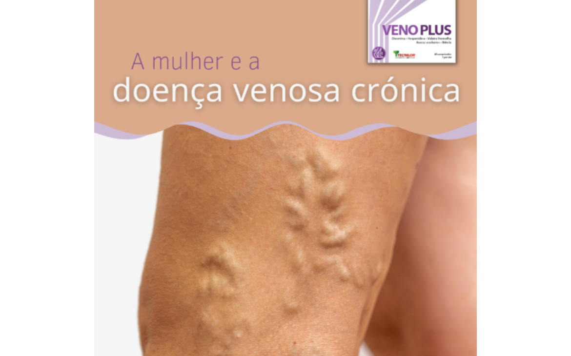 Doença Venosa Crónica - Tecnilor